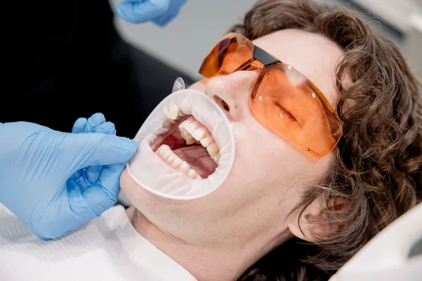 Teeth Whitening