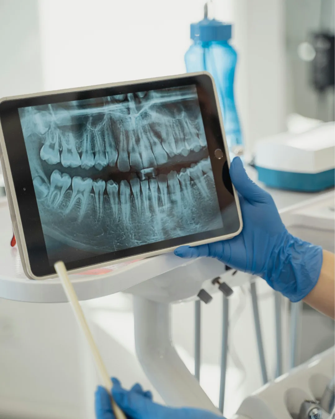 Digital dental X-ray reviewed on a tablet during an emergency assessment at Auburn