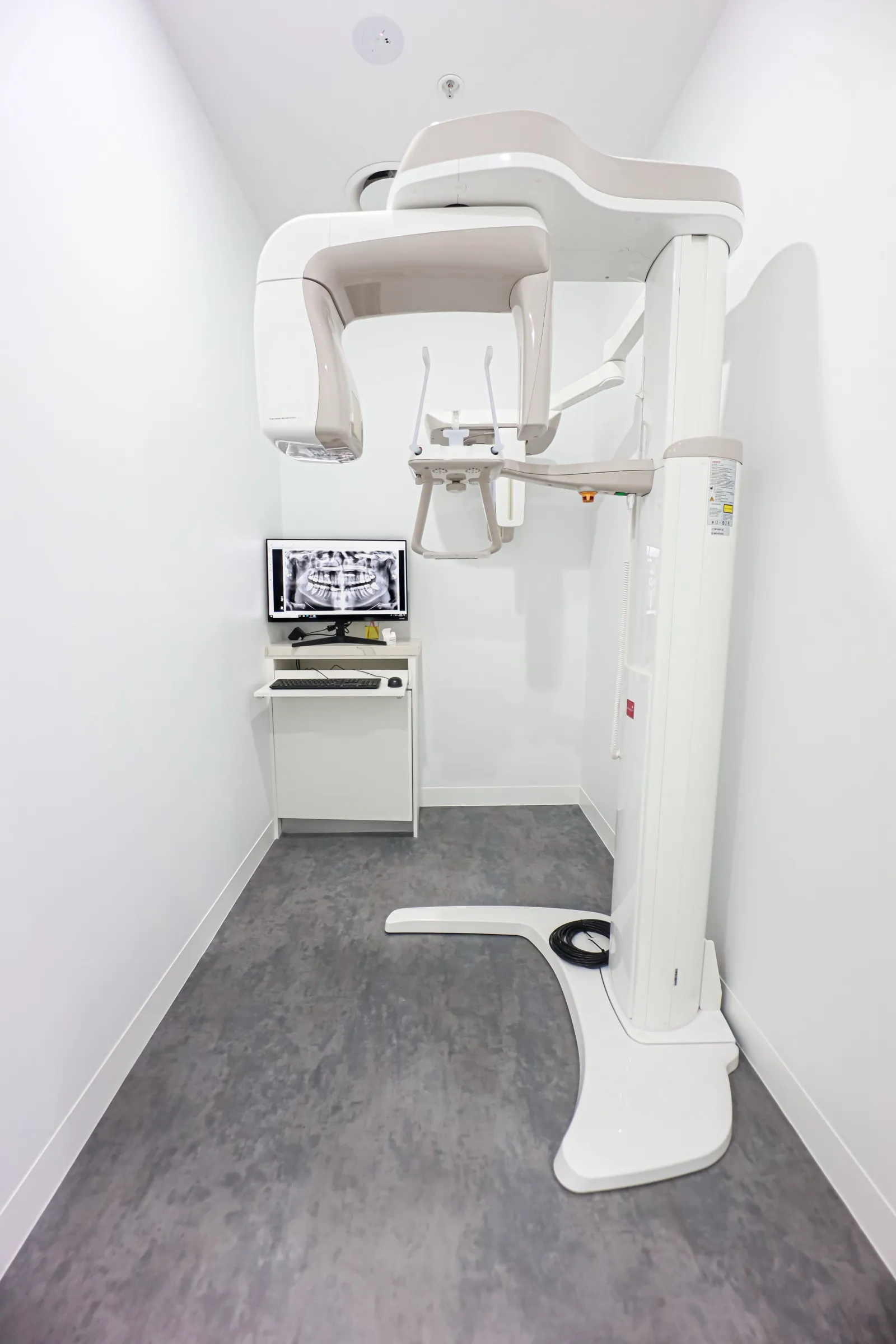 OPG digital X-ray scanner at My Local Dentists Northbridge used to diagnose dental emergencies