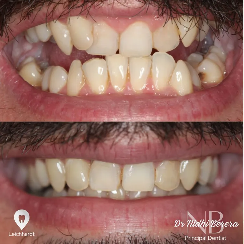 Orthodontics transformation by Dr Nidhi Berera