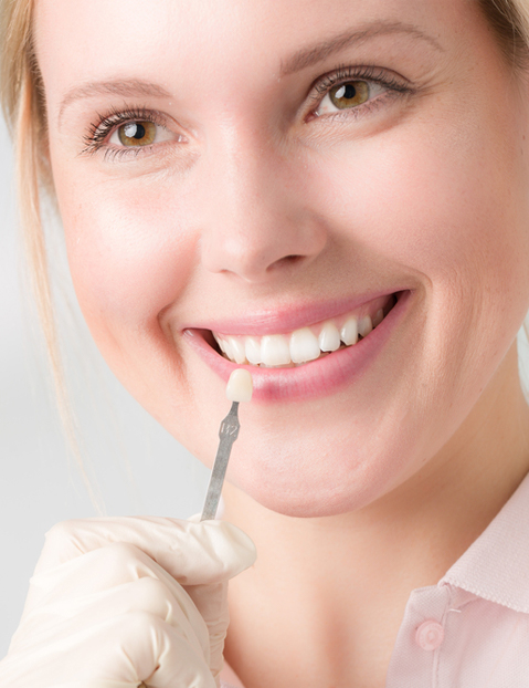 porcelain dental veneers - best oral health care
