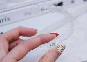 process how long does invisalign take burwood