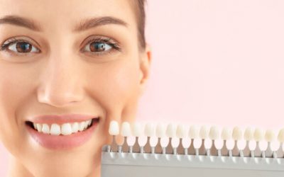 How Do Veneers Work? Discover If Are They Really Worth It