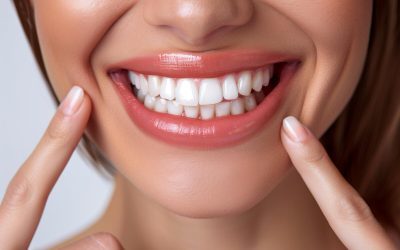 Is Teeth Whitening Safe? Here’s What You Should Know