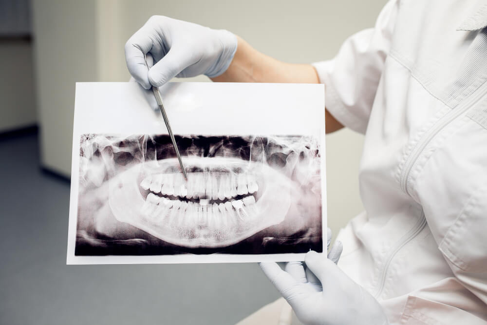 how successful are bone grafting procedures