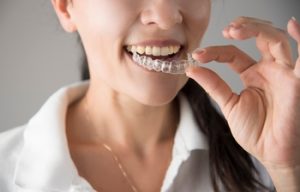 results expectation invisalign burwood