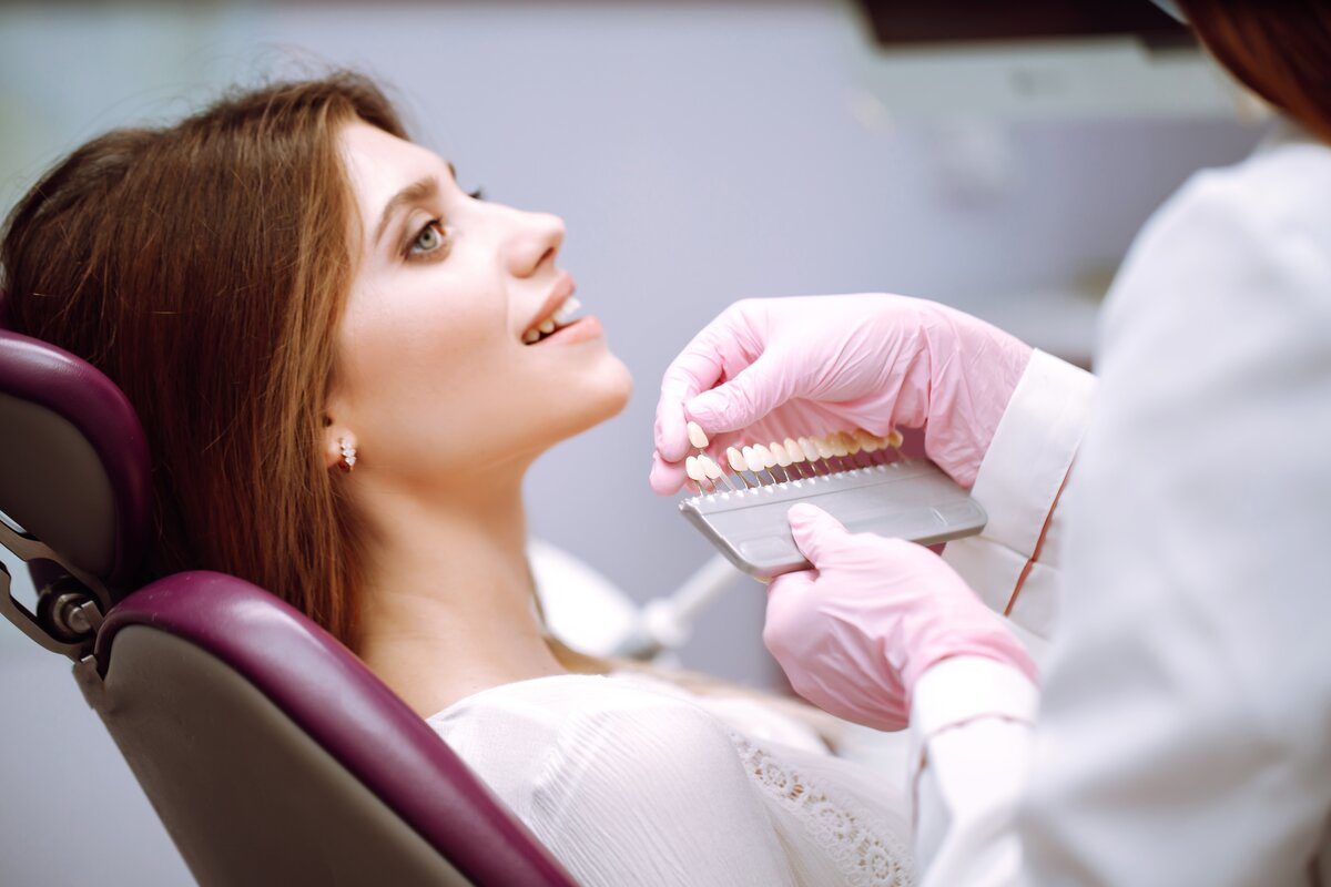 cost of composite veneers Burwood