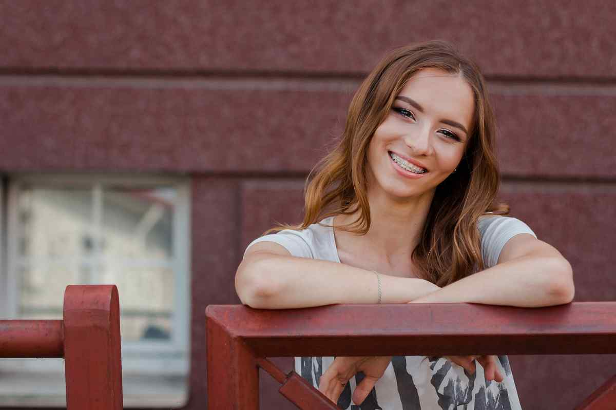 how much are veneers for teeth burwood