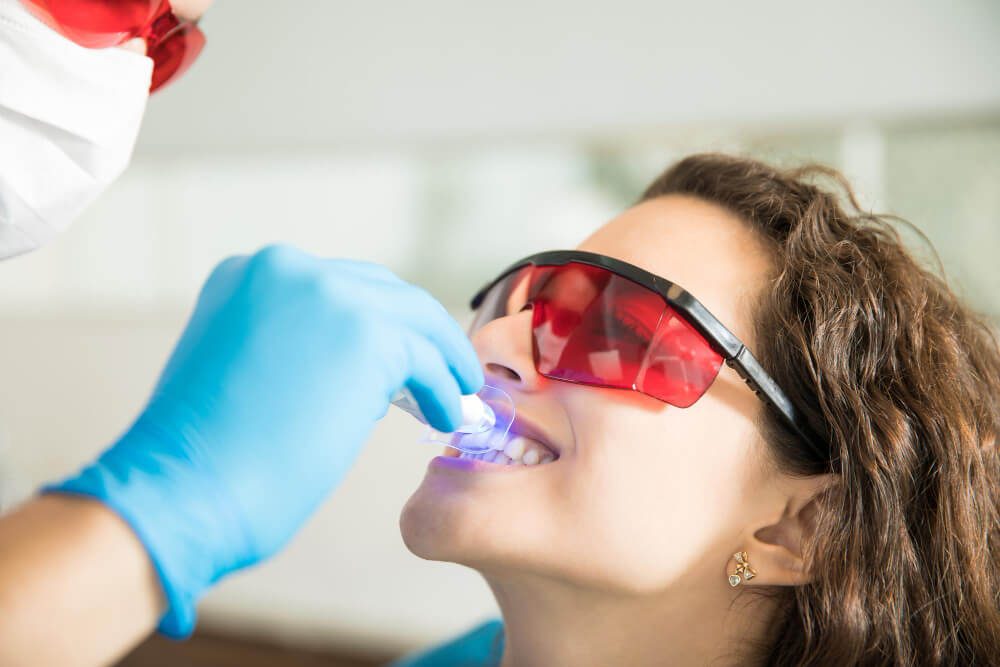 teeth whitening myths busted