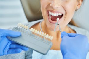 Teeth Whitening Procedure benefits