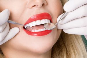 Sensitive Teeth After Whitening check burwood
