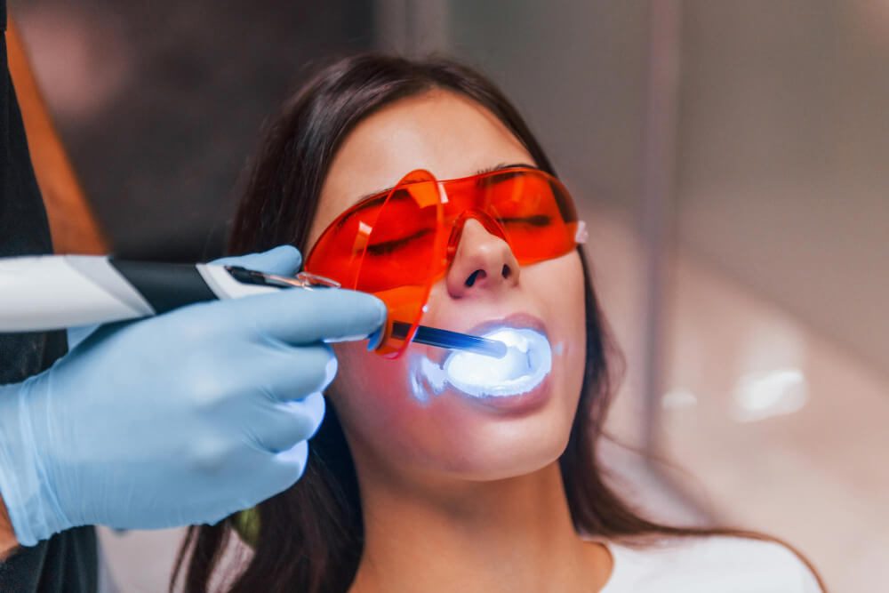 Professional teeth whitening