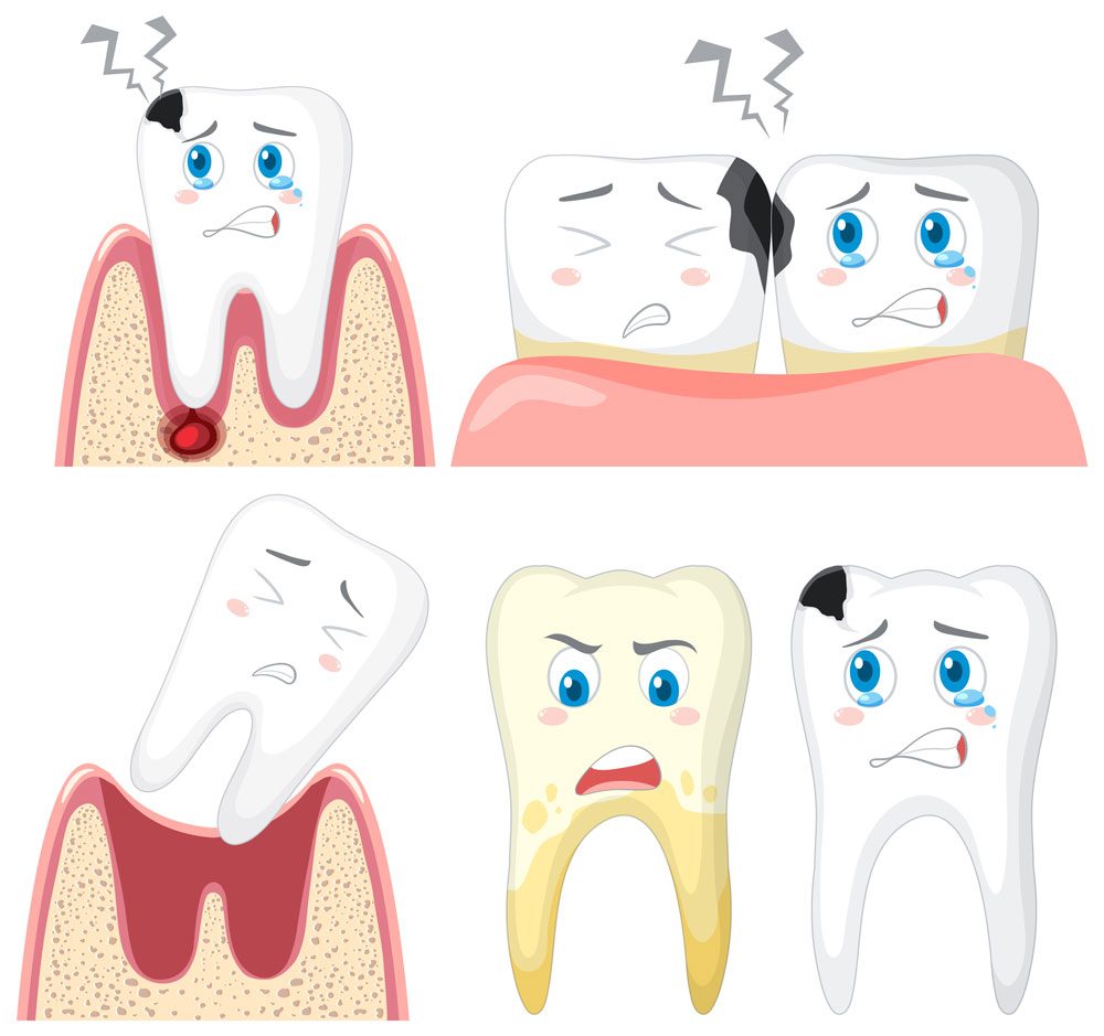 Early Detection of Dental Issues