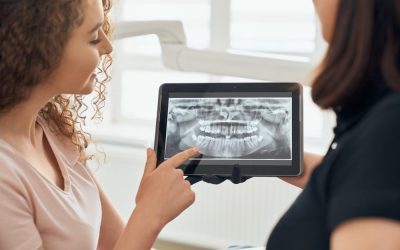 Ask the Dentist: Why are Dental X-Rays important when visiting the dentist?