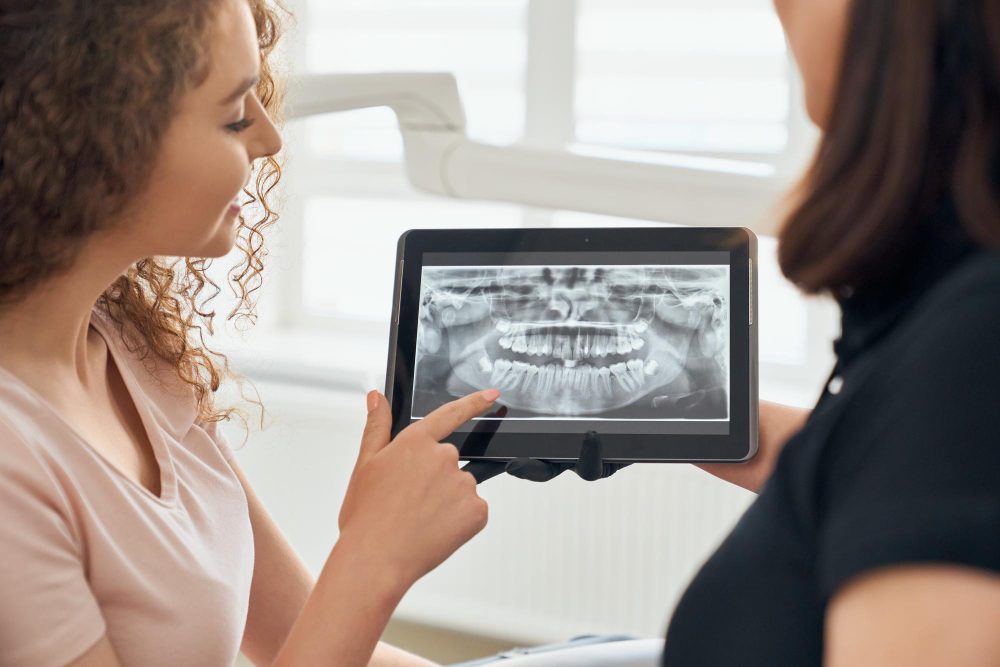 Why are Dental X Rays important when visiting the dentist