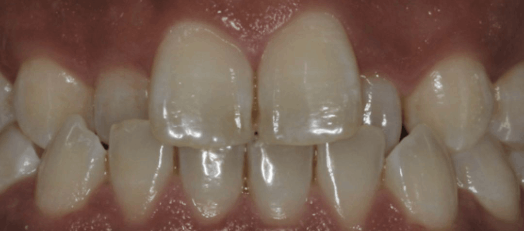 orthodntics aft