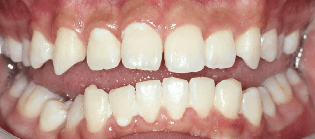 orthodontics after (1)