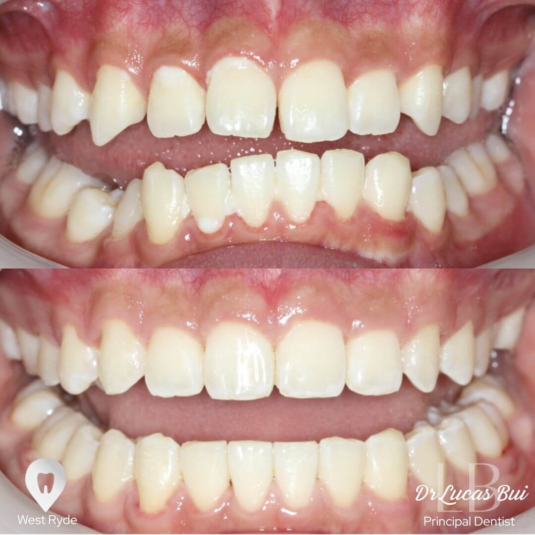 orthodontic