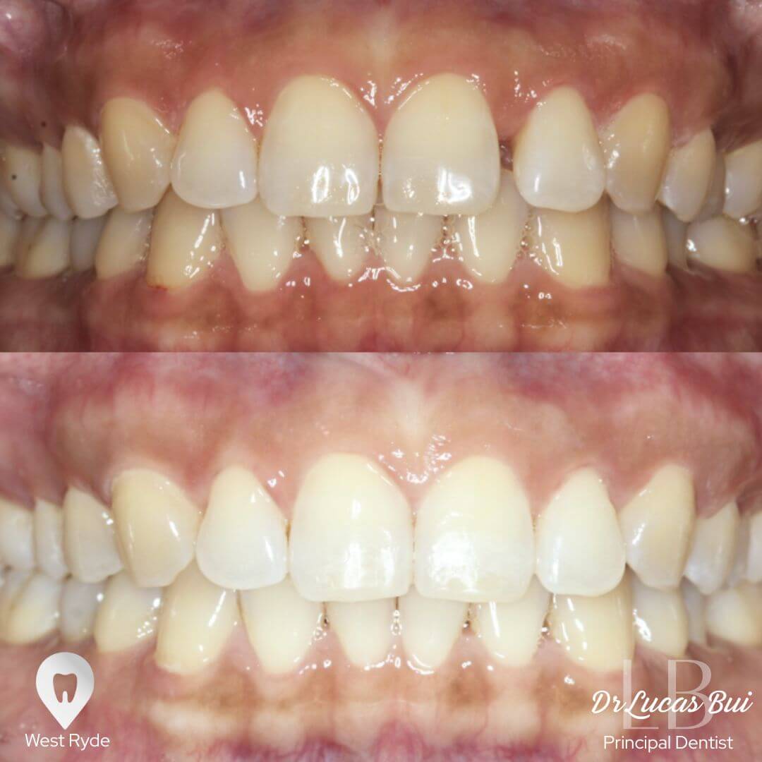 orthodontics 2