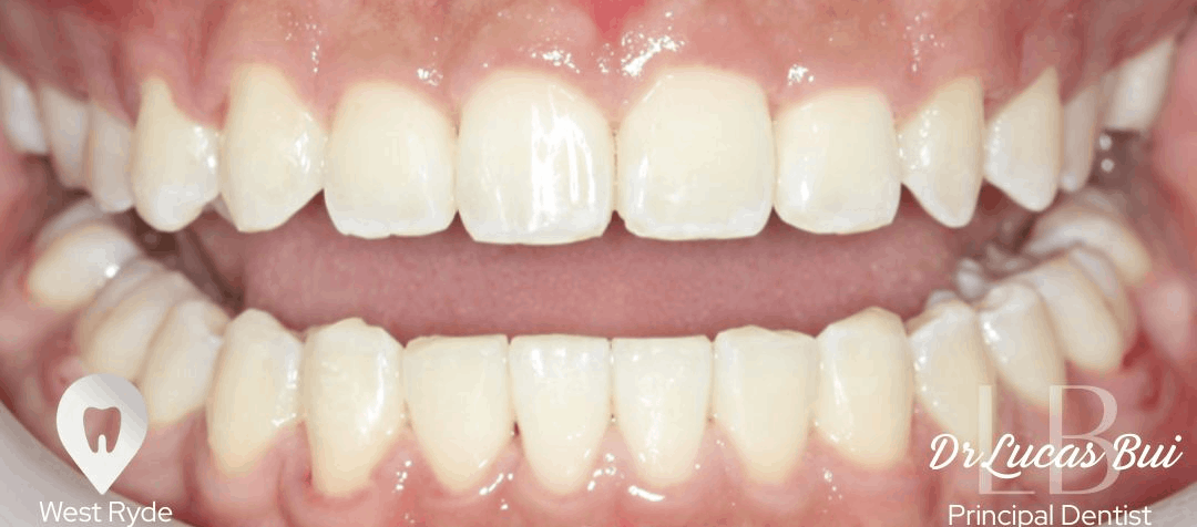 orthodontics after (1)