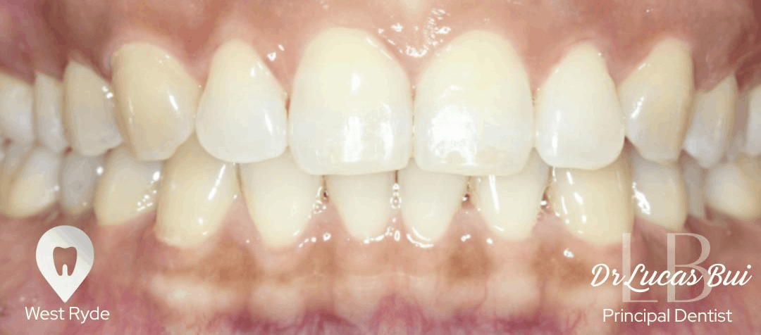orthodontics after