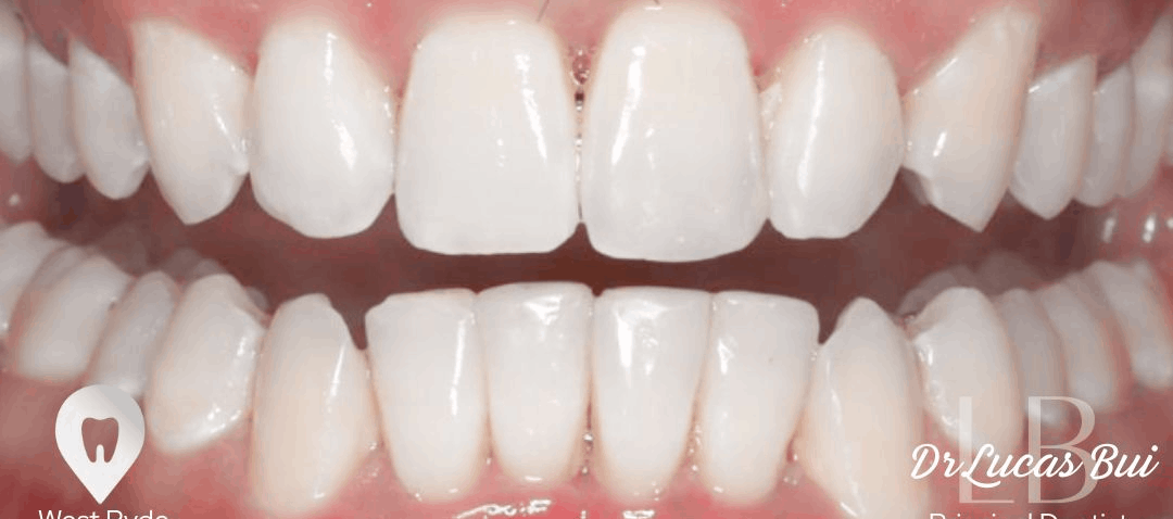 orthodontics after