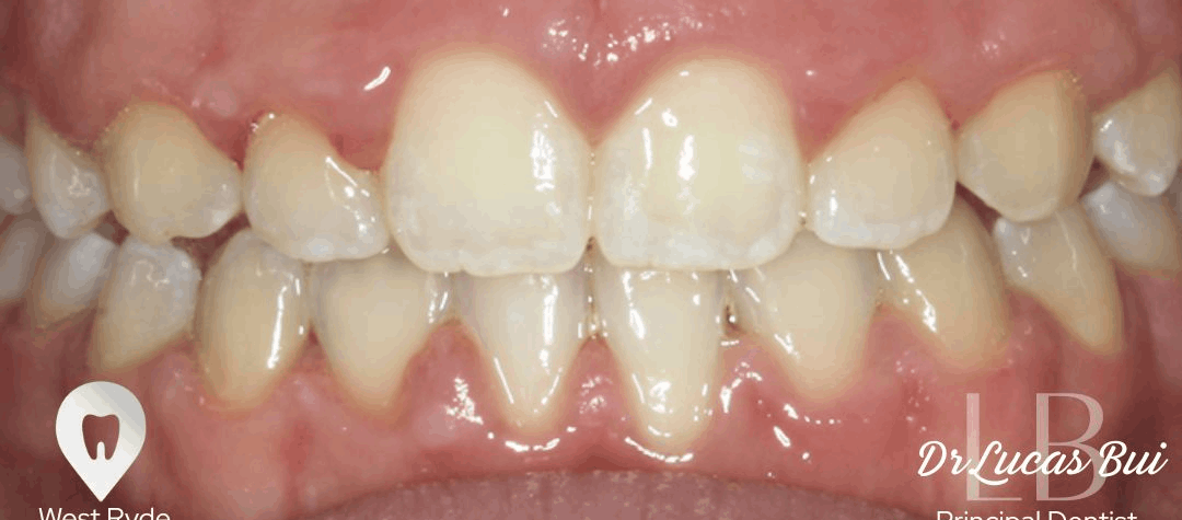 orthodontics after