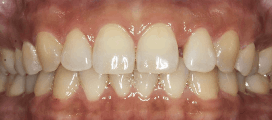 orthodontics after