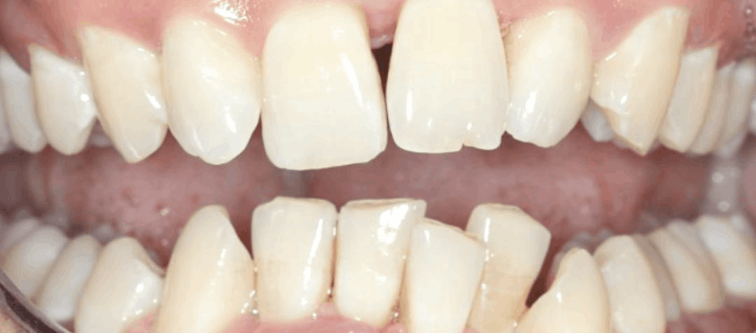 orthodontics after
