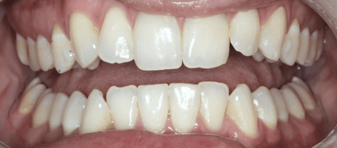 orthodontics after