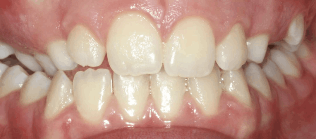 orthodontics after