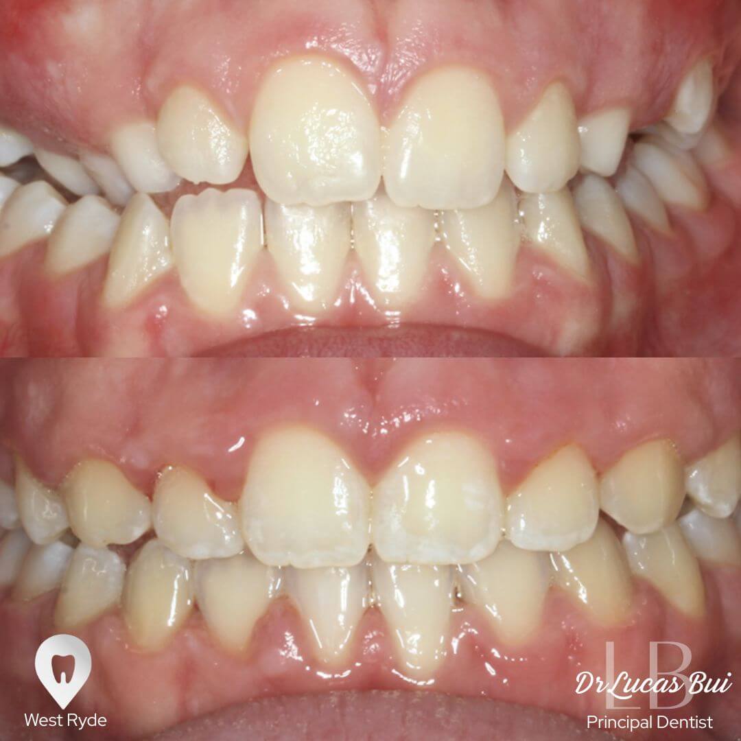orthodontics