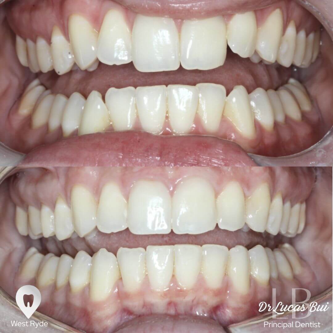 orthodontics1