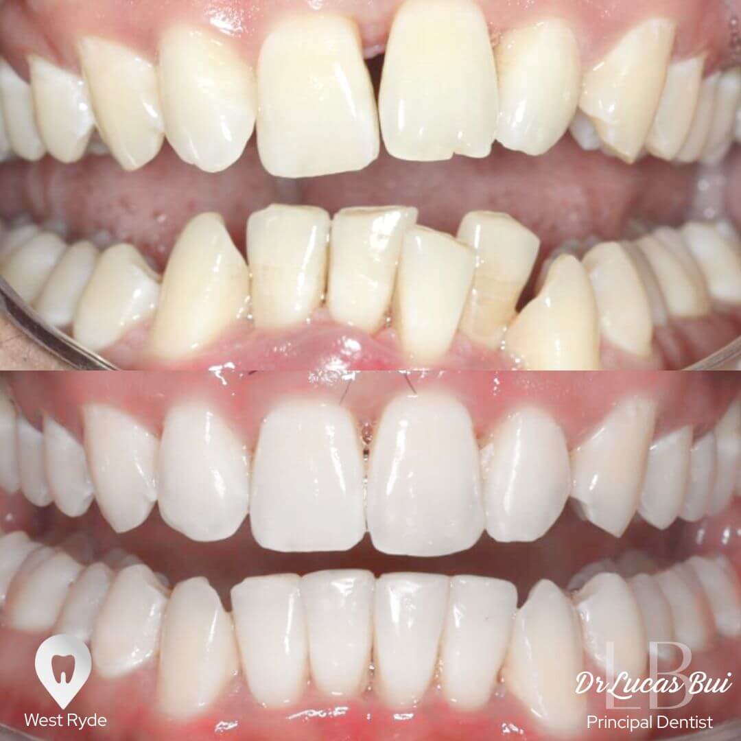 orthodontics3
