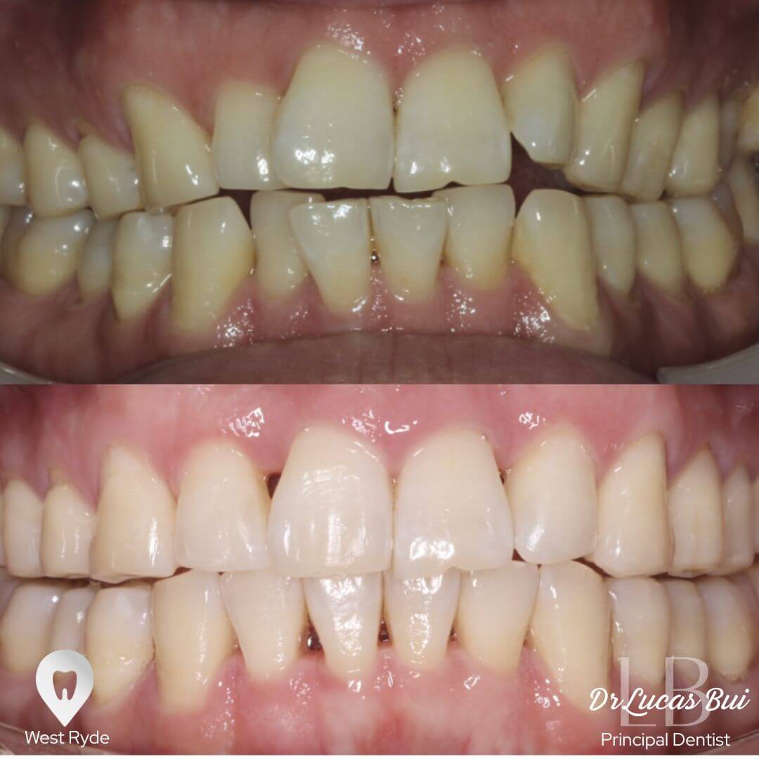 ortjodontics4
