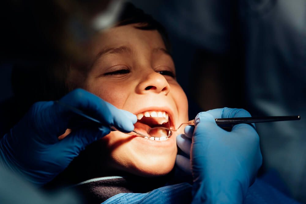 Dental Sealants Sydney 1