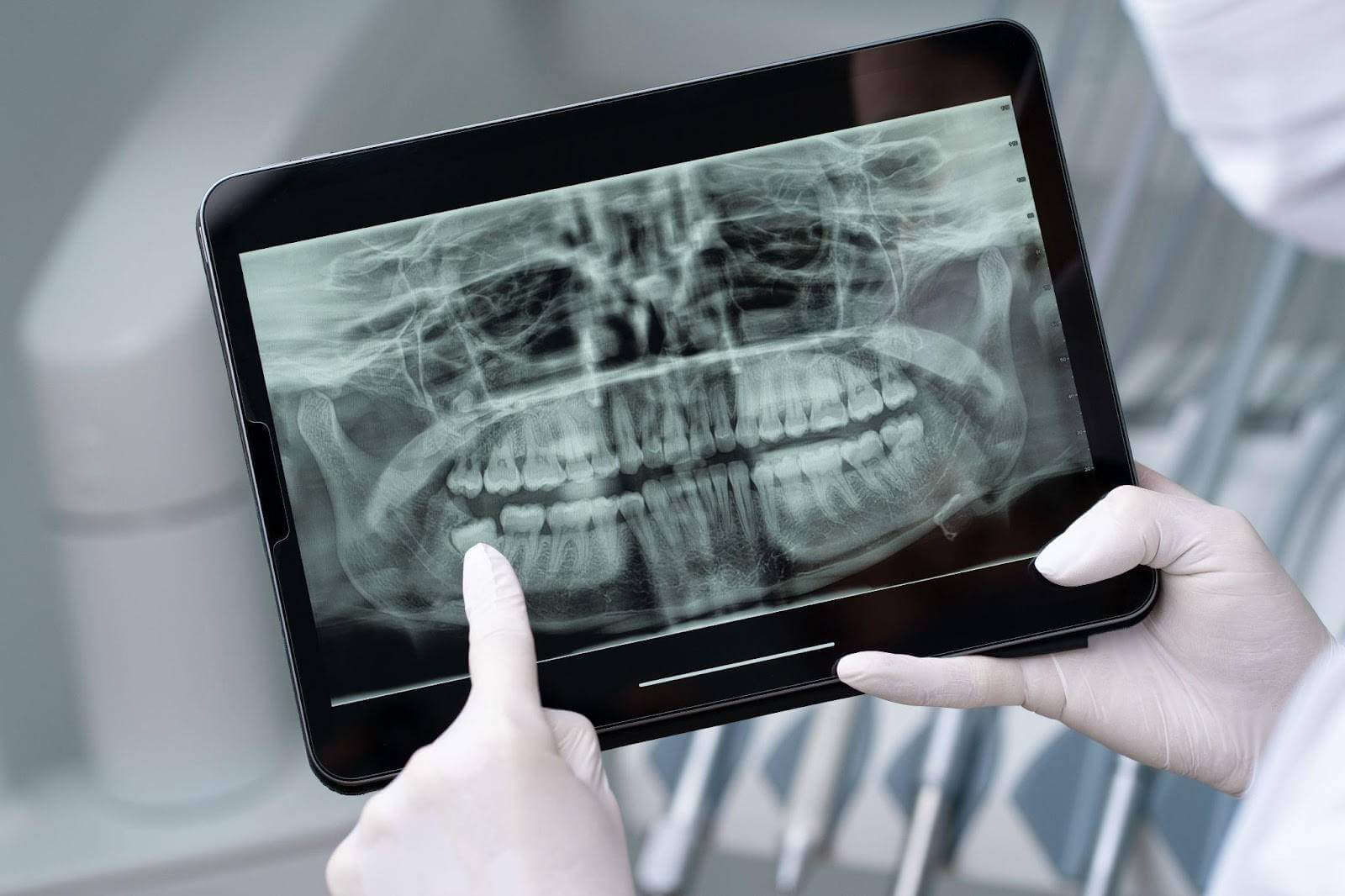 Dental X-ray Sydney